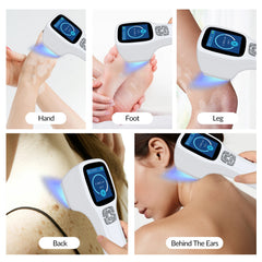 ZJZK 308 nm Excimer-Gerät – Effektive natürliche Lichttherapie für Psoriasis, Vitiligo und Ekzeme zu Hause